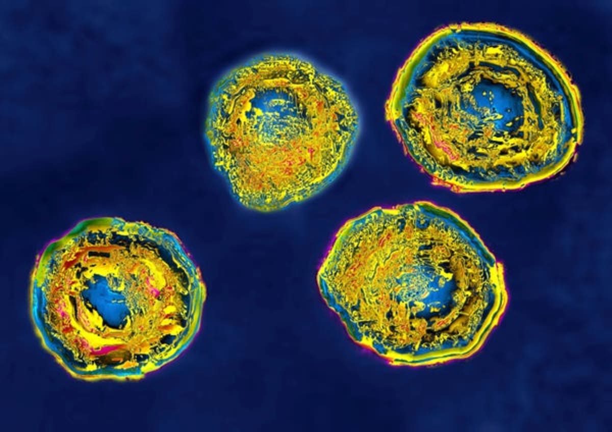 AI Tool Could Make Better Herpes Tests Available to All - Image 2