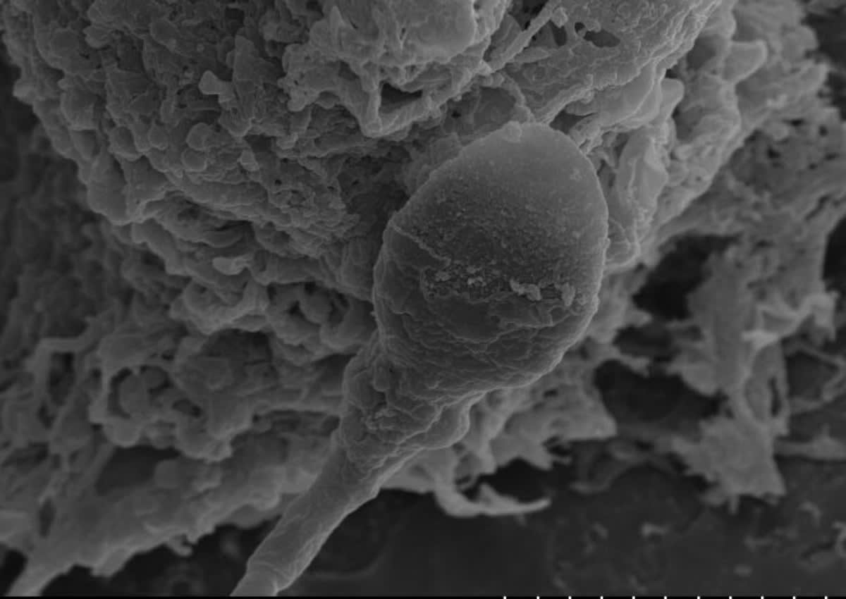 Microscopic view of human sperm cells in laboratory chamber simulating space microgravity conditions