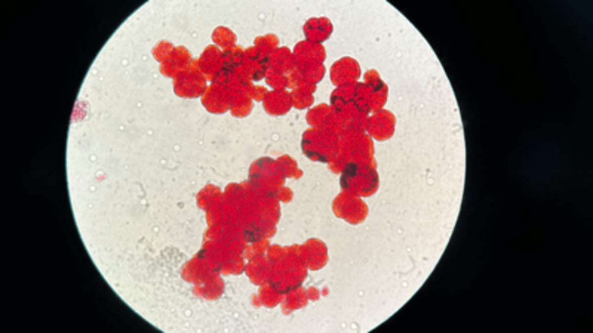 4,000-Year-Old Sheep Bone Rewrites Plague History - Image 2