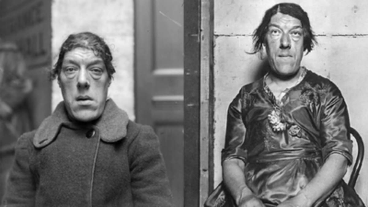 Mother Earned $50K in 1920s Freak Shows to Educate Her Kids - Image 2