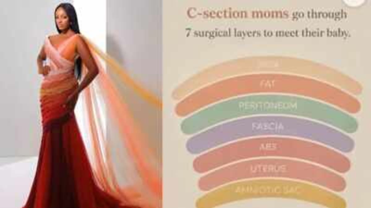 Uganda's Miss World Gown Honors C-Section Mothers - Image 2
