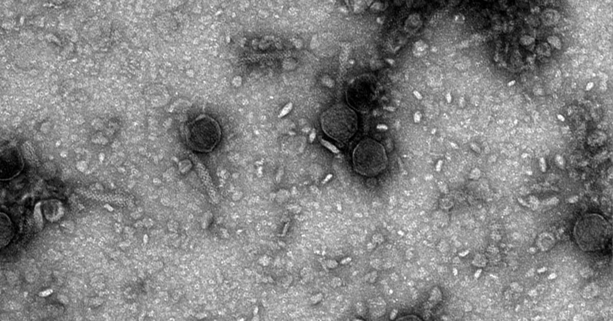 Scientists Discover 4-Billion-Year-Old Gene Editor in Viruses