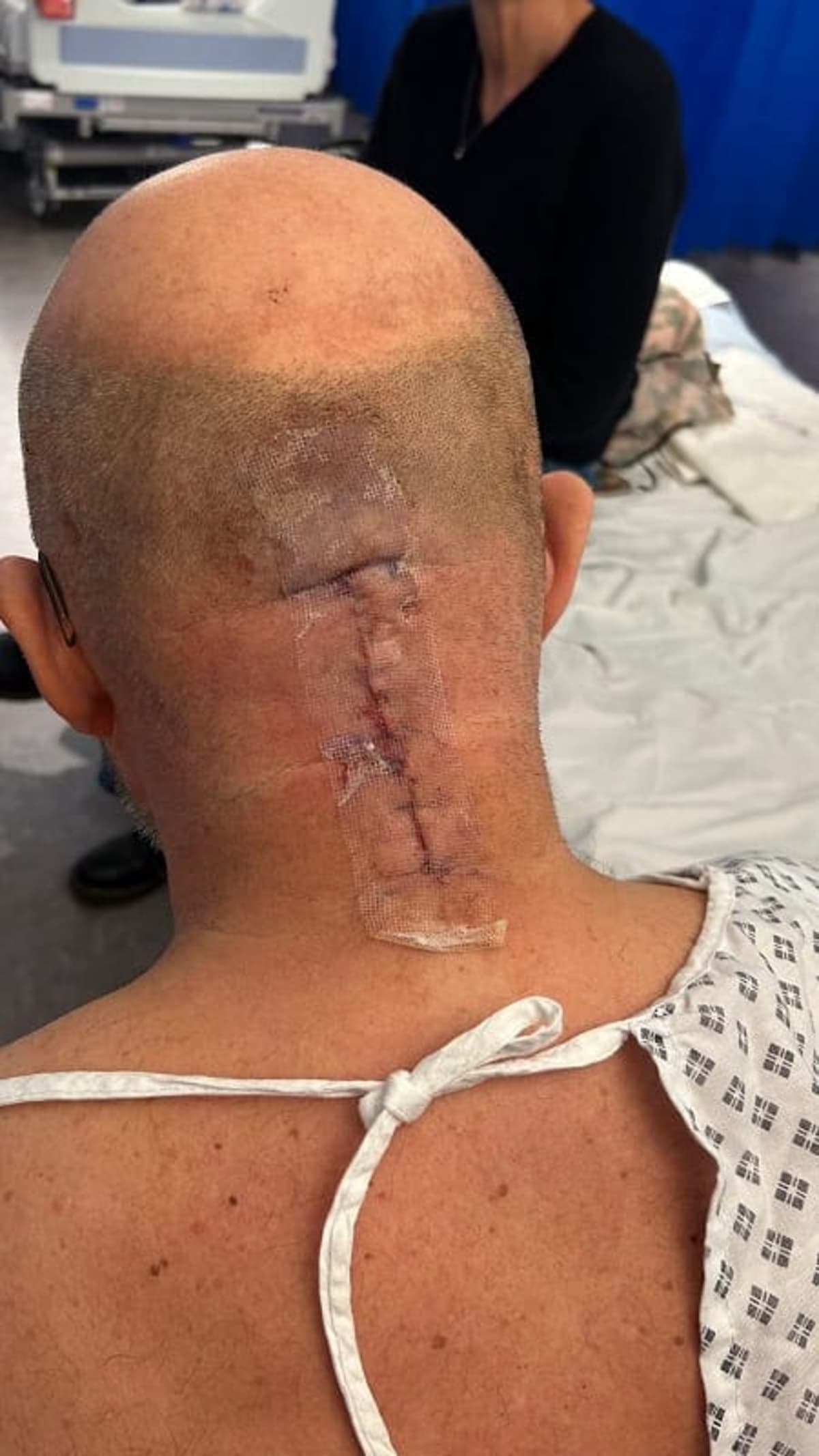 Dad Survives 12-Hour Brain Surgery, Son Runs London Marathon - Image 5