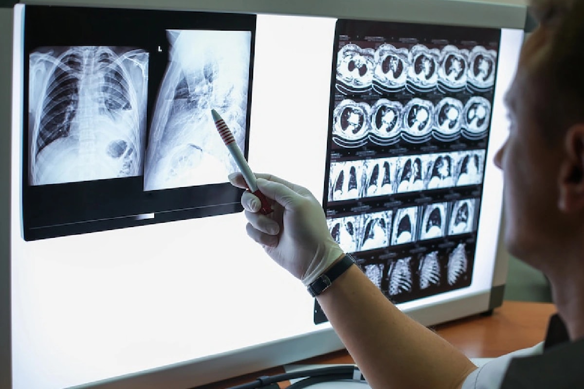 Australian RNA Therapy Targets Lung Disease at Its Source