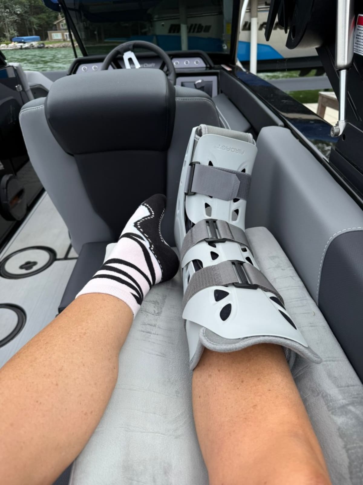 Wisconsin Woman Water-Skis Again After Shattering Ankle - Image 4