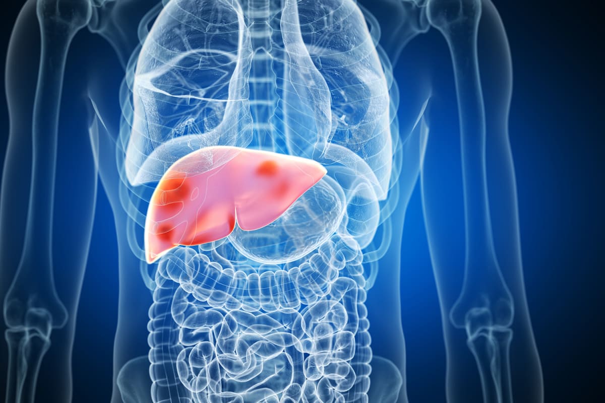 UConn Scientists Develop Treatment for Fatty Liver Disease