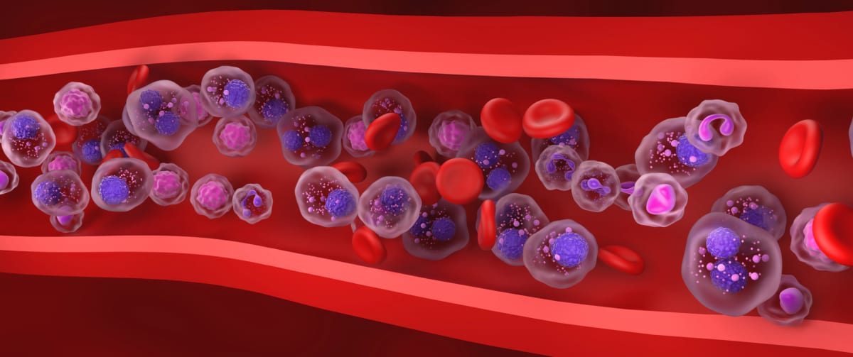 New Blood Cancer Drug Helps 44% of Relapsed Patients - Image 2