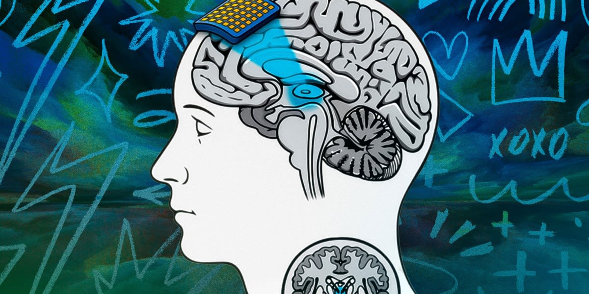 Abstract illustration showing ultrasound waves focusing on illuminated regions within a transparent human brain