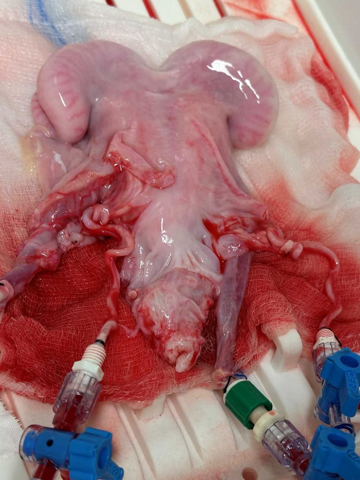 Scientists Keep Human Uterus Alive Outside Body for 24 Hours - Image 3
