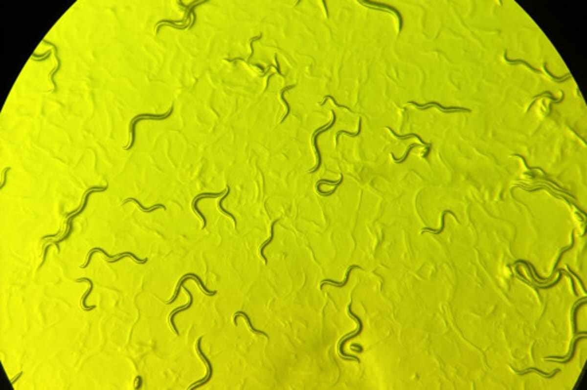 Tiny Worms Could Unlock Treatment for Rare Child Paralysis - Image 2