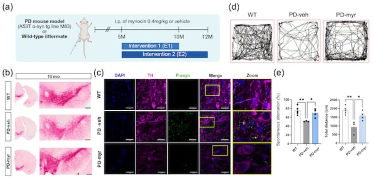 Korean Scientists Slow Parkinson's Disease in Mice - Image 2