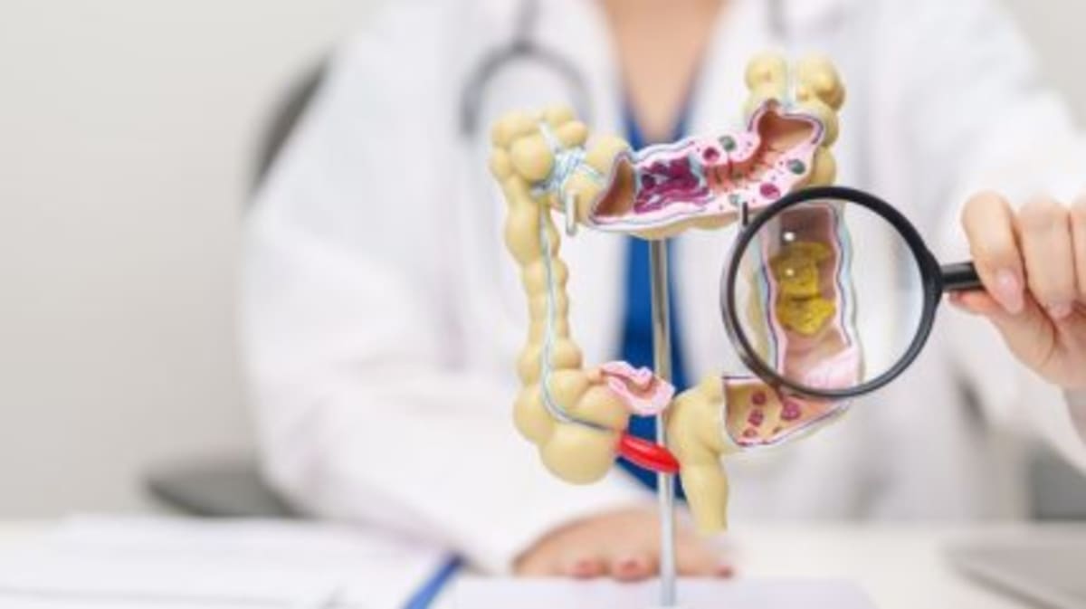 New Cancer Drug Shows 78% Response in Colorectal Patients - Image 2