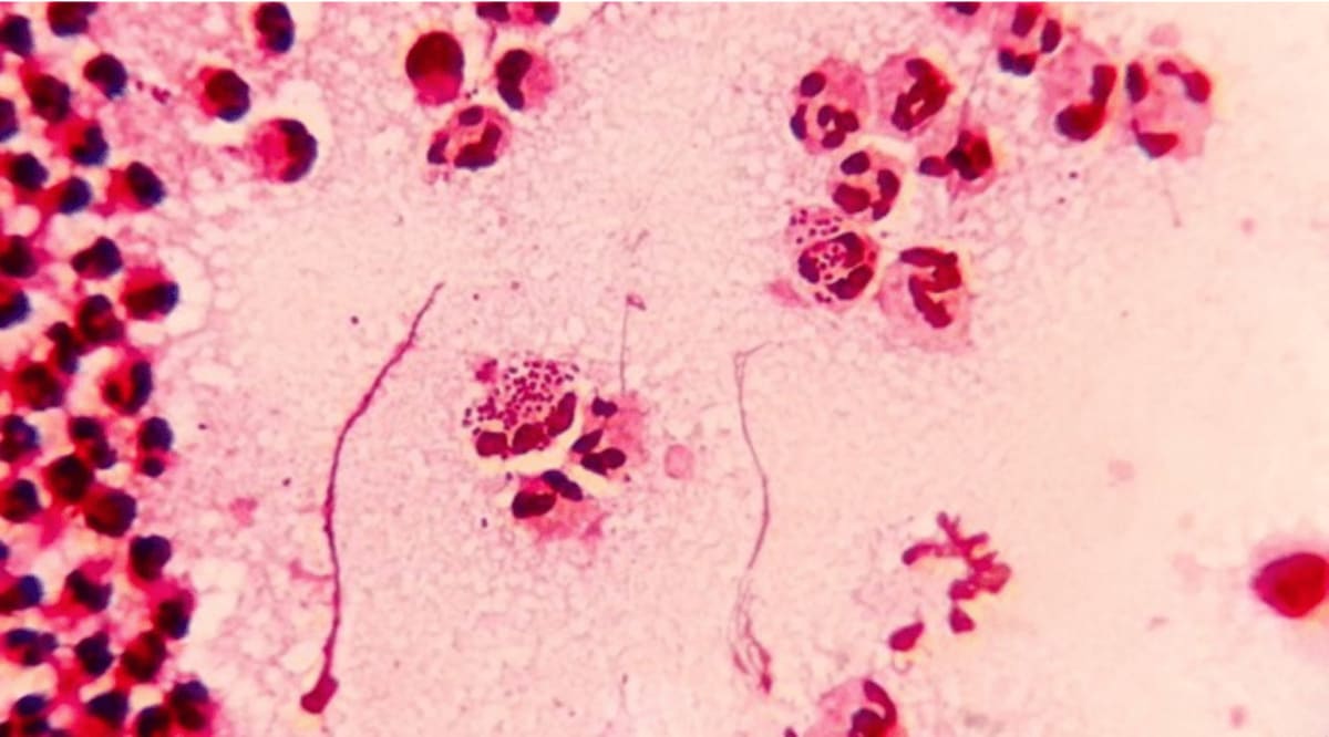 New Oral Antibiotic Shows 90% Cure Rate for Gonorrhoea - Image 4