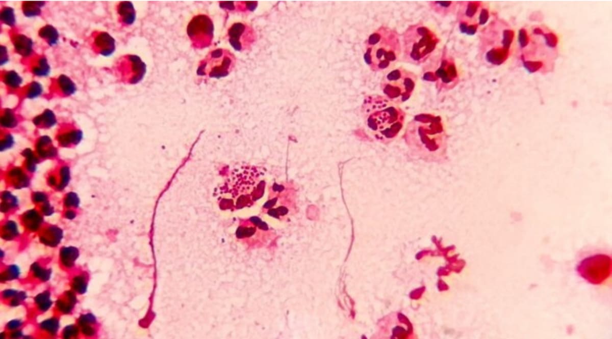 New Oral Antibiotic Shows 90% Cure Rate for Gonorrhoea