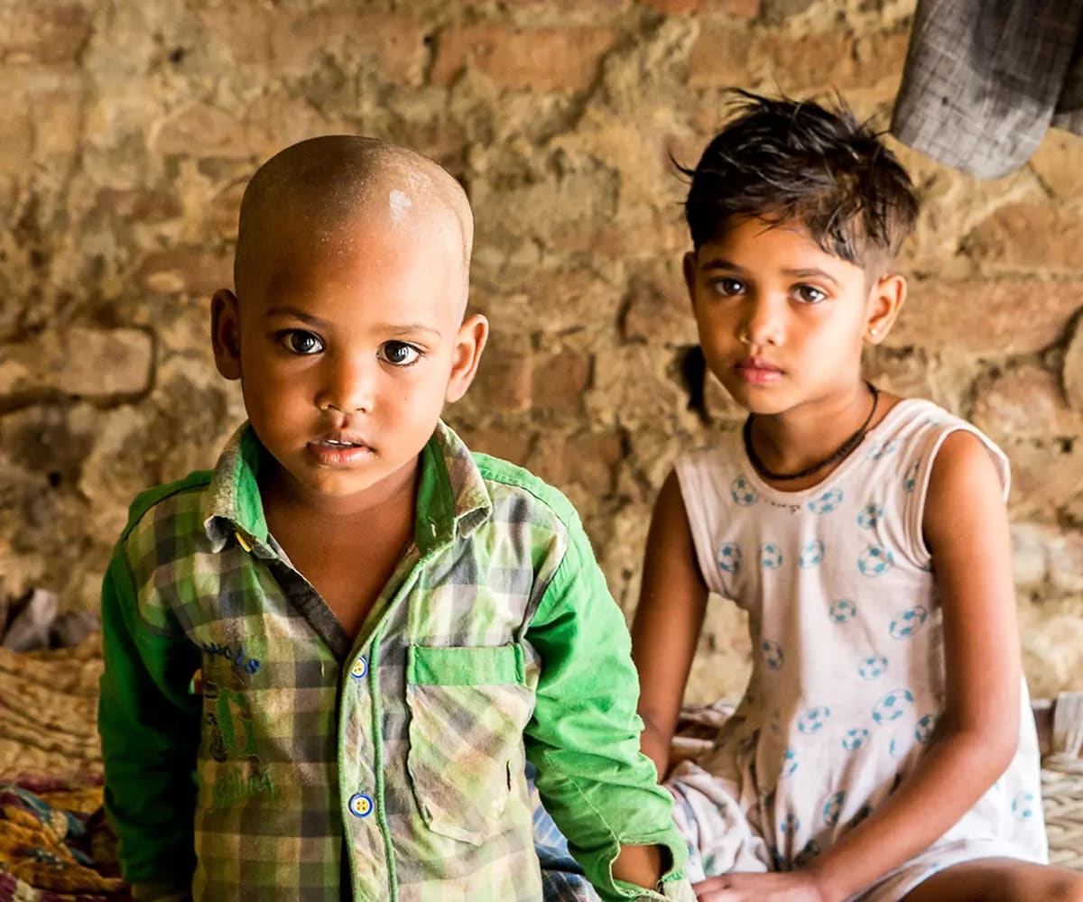 Young child receiving peanut-based therapeutic food treatment for severe malnutrition in developing country