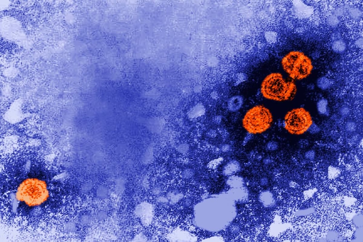 Hepatitis B Drug Shows 20% Cure Rate in Breakthrough Trial - Image 2