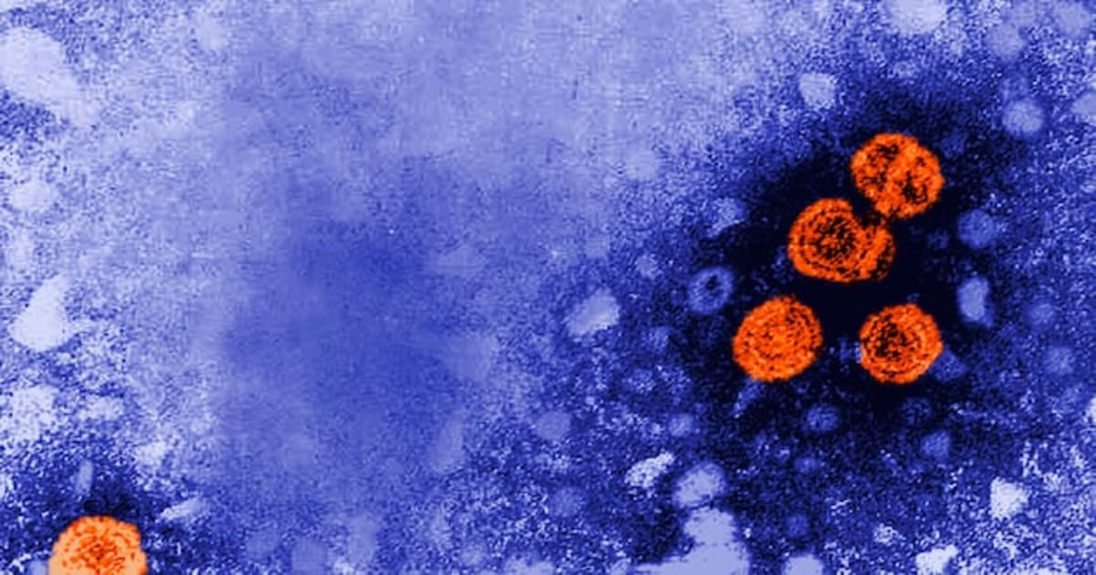 Orange hepatitis B virus particles viewed through electron microscope from CDC archives