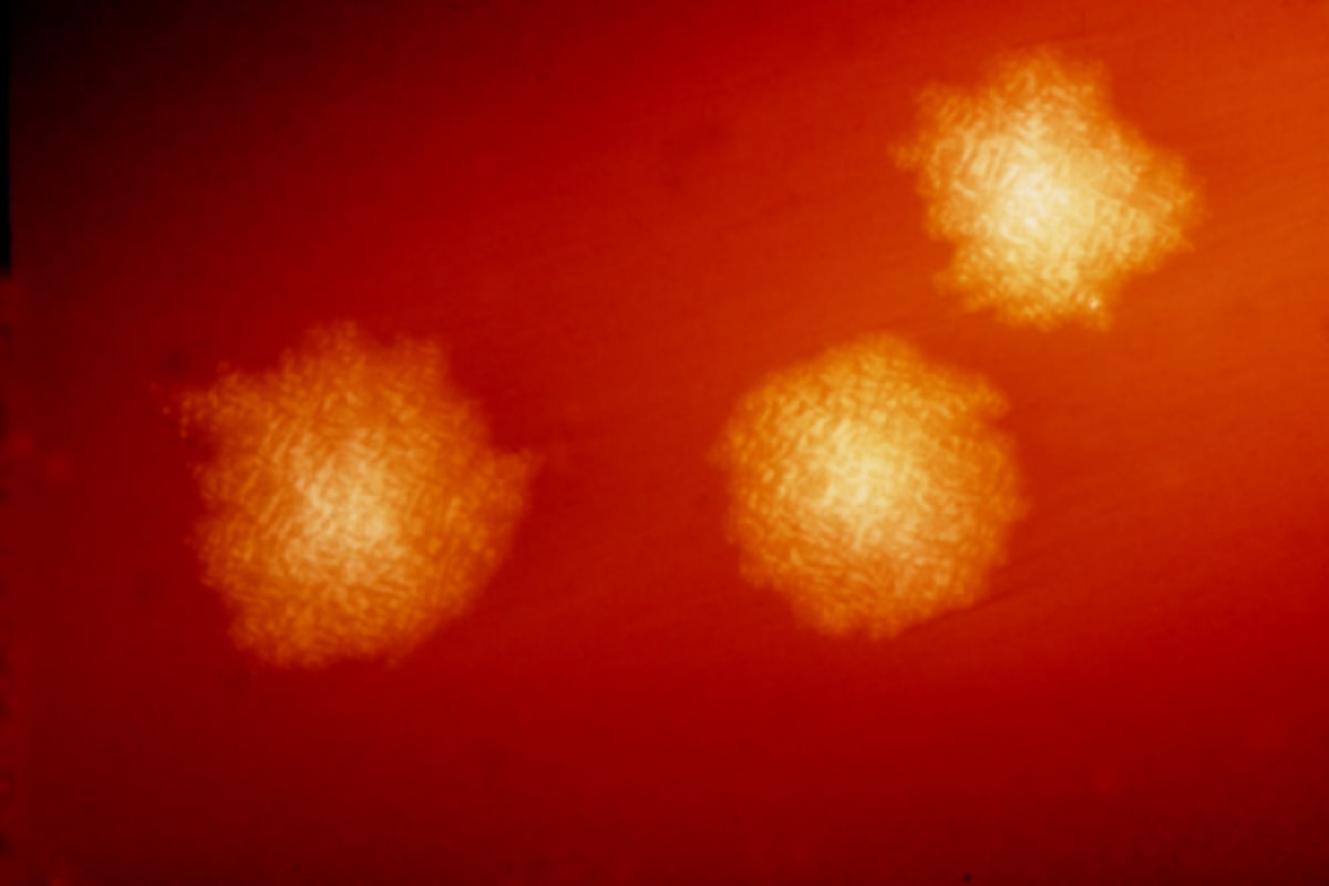 3 Canadian Scientists Win Award for Health Breakthroughs - Image 3
