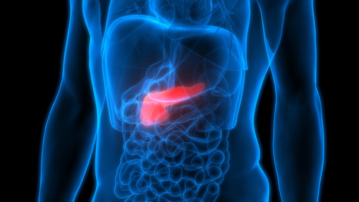 World's First Pancreatic Cancer Gene Therapy in Netherlands