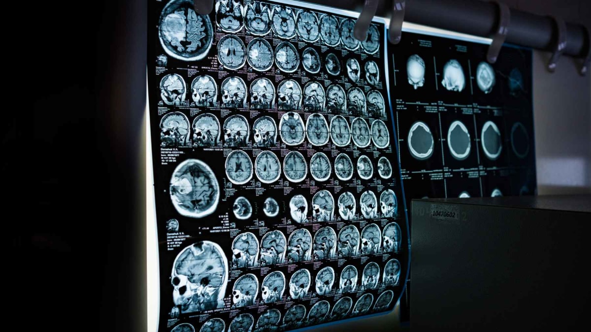 Cannabis Users Over 40 Show Better Memory in 26K Study - Image 2