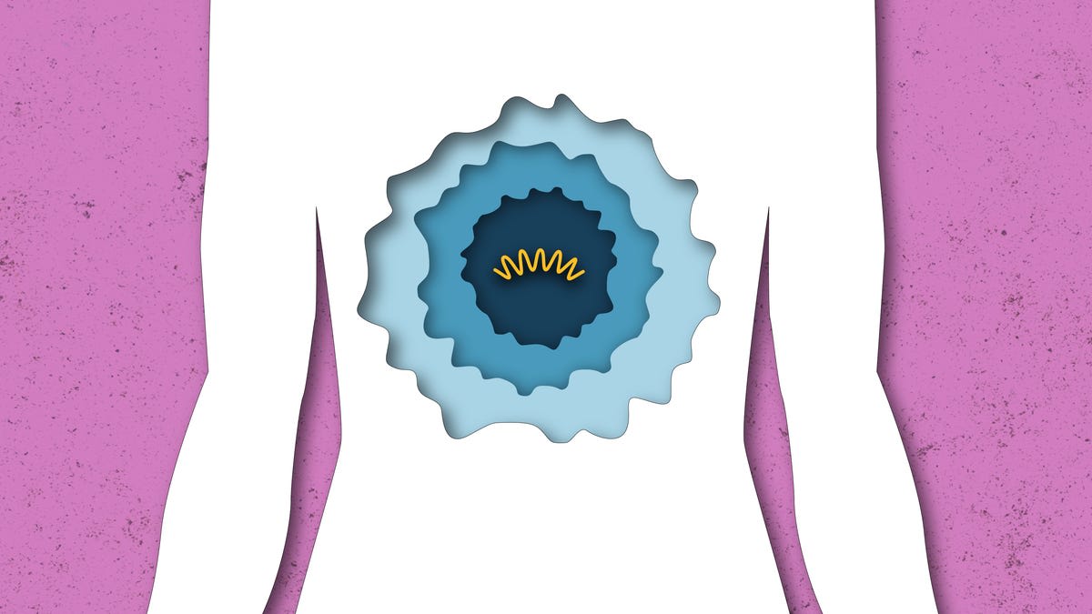 Medical illustration showing how personalized mRNA cancer vaccines train immune system to target tumor cells