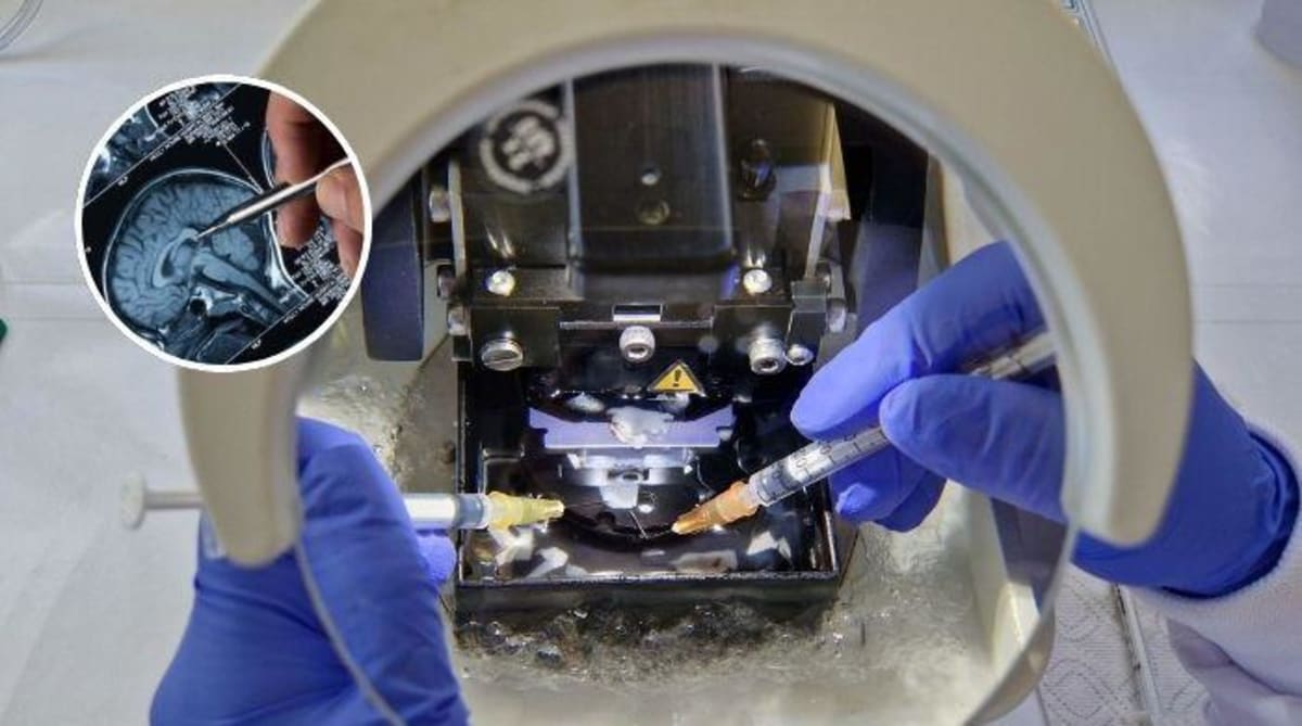 Scientists Rewake Dead Brain Tissue in Medical First