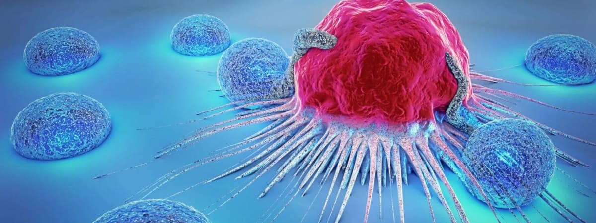 Scotland Gets AI Microscope That Hunts Disease Cells