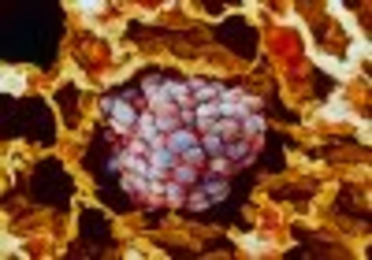 OpenAI Foundation Invests $125M in Health Data Access - Image 5