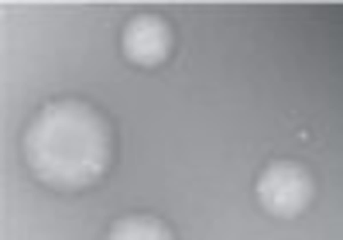 New mRNA Vaccine Cuts Neuroblastoma Tumors 70% in Mice - Image 4
