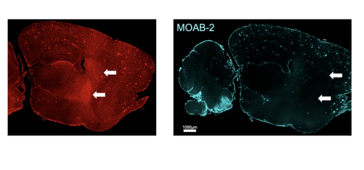 UK Scientists Restore 2 Hours of Sleep in Alzheimer's Study - Image 2