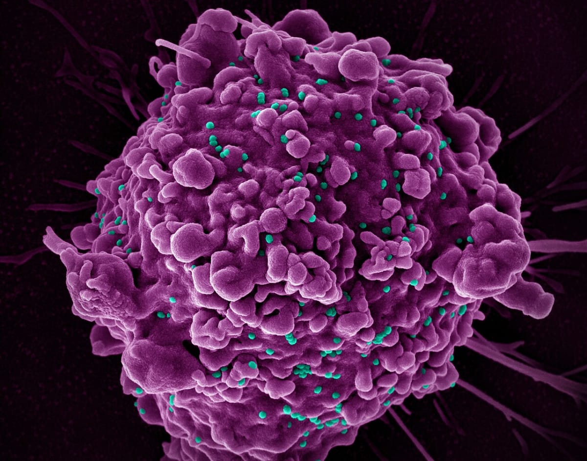 Scientists in laboratory examining vaccine vials representing groundbreaking HIV research and hope for prevention