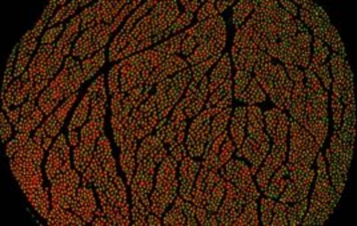 MIT Finds Pink Noise Boosts Brain Cleaning During Sleep - Image 5