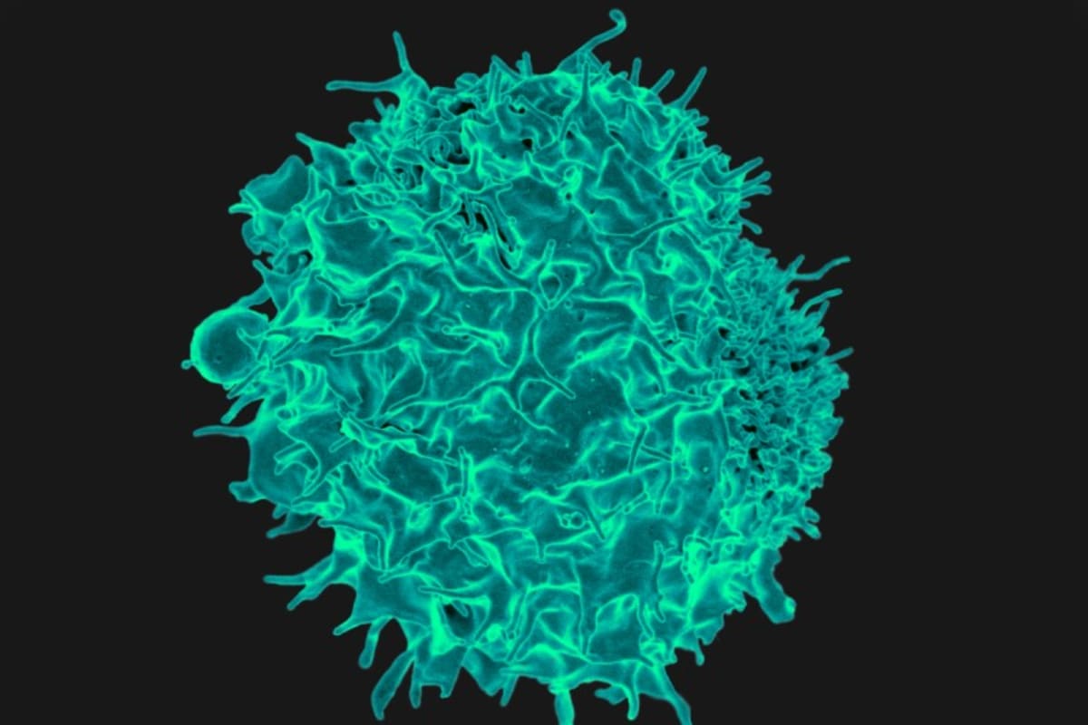 Scientists Create New Leukemia Treatment From Survivors' Cells