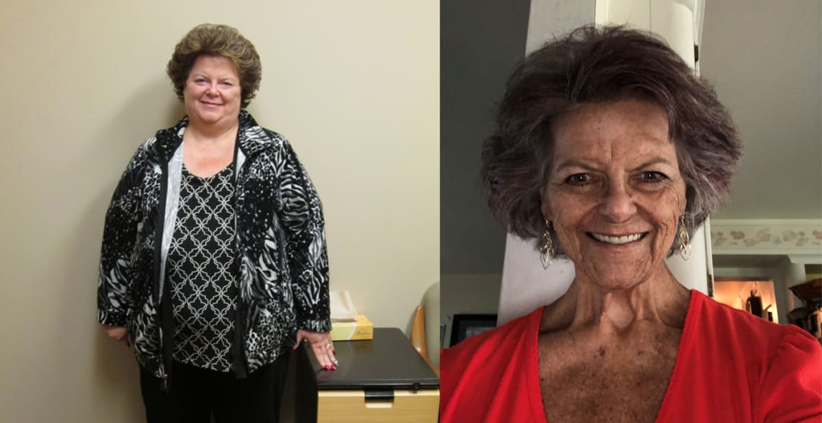 Genetic Test Unlocks New Treatment for Obesity Patient