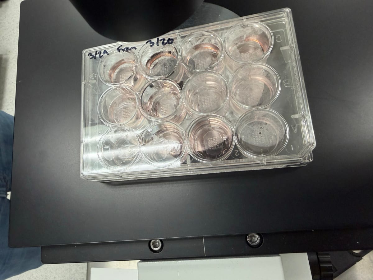 Space Station Bacteria Study Could Save Millions of Hearts - Image 3