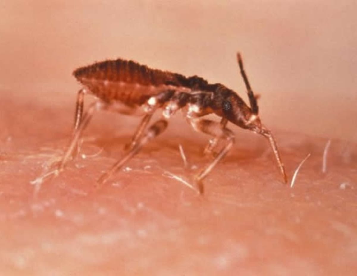 Microscopic view of Trypanosoma cruzi parasite that causes Chagas disease in laboratory research setting