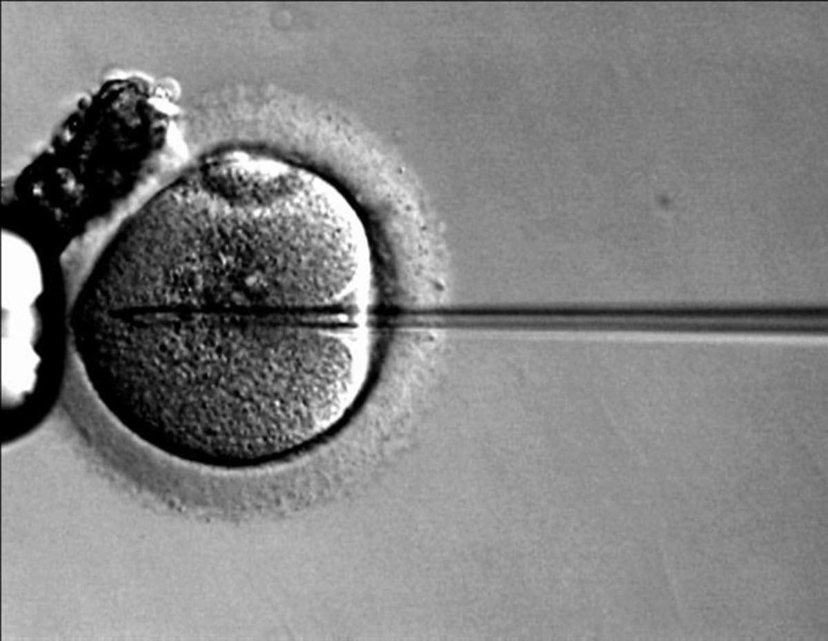 Scientists examining muscle tissue samples in laboratory conducting gene therapy research