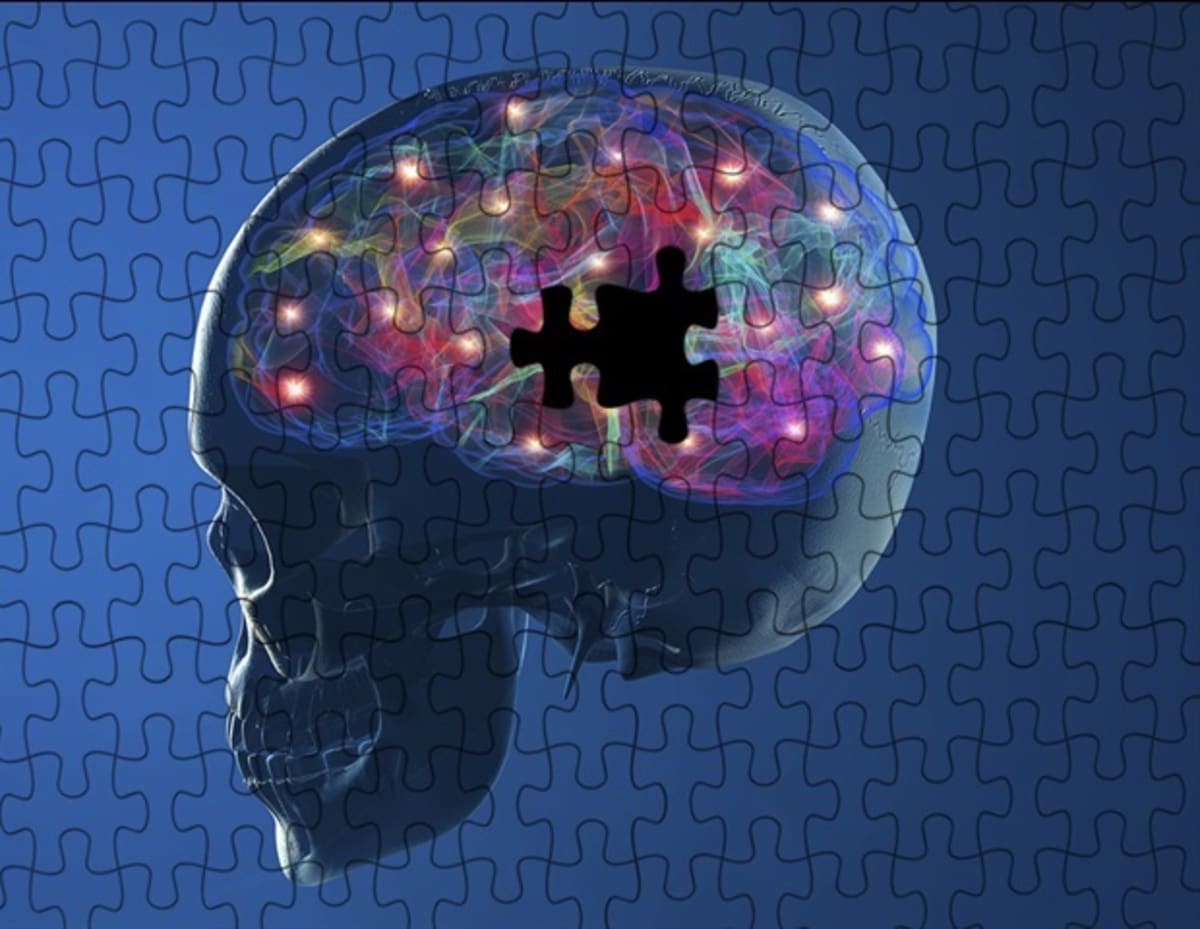 New Parkinson's Drug Candidate Cuts Side Effects in Study
