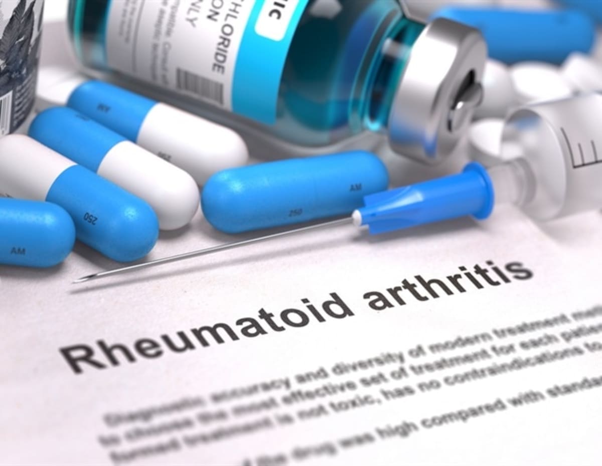 CAR T-Cell Therapy Puts 3 Severe Arthritis Patients in Remission