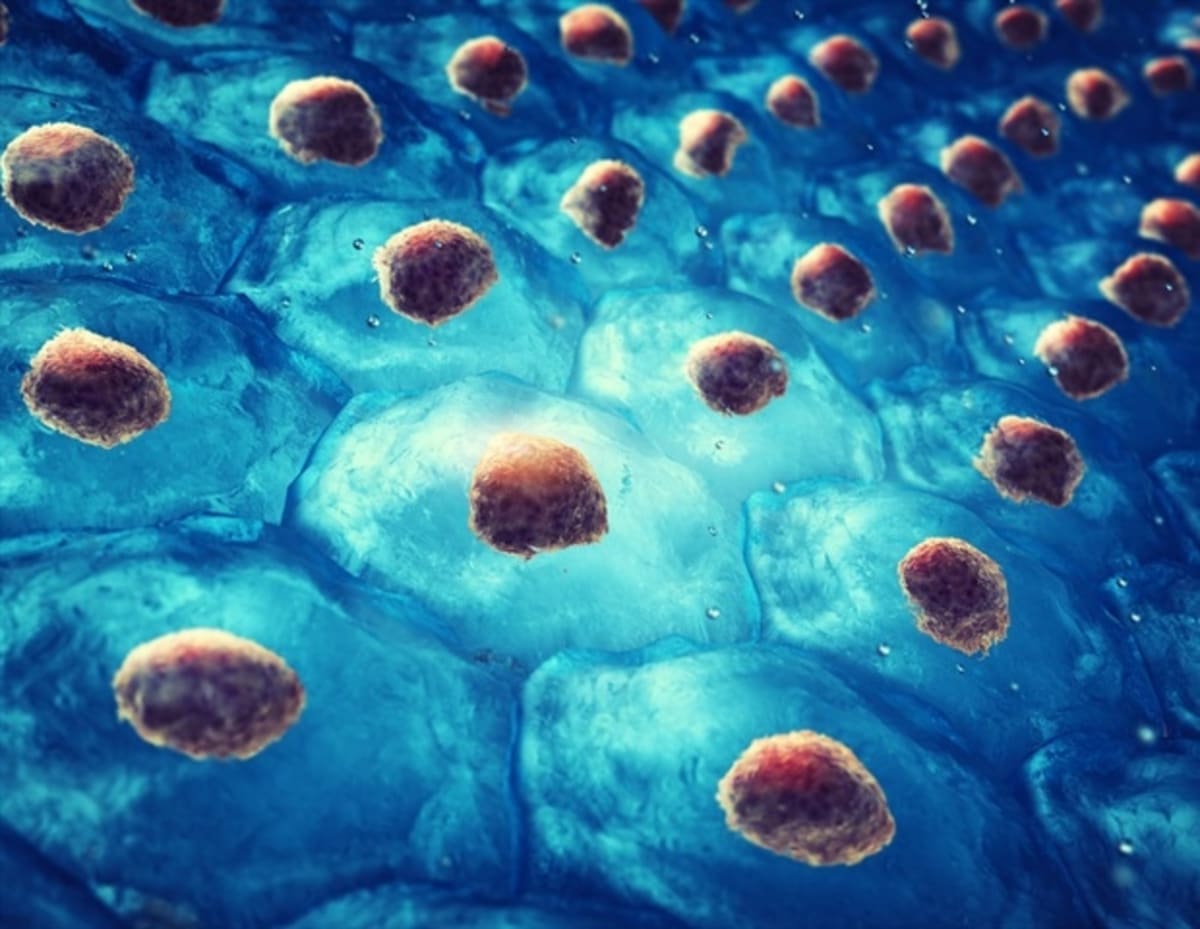 Scientists Find New Way to Fight Deadliest Brain Cancer