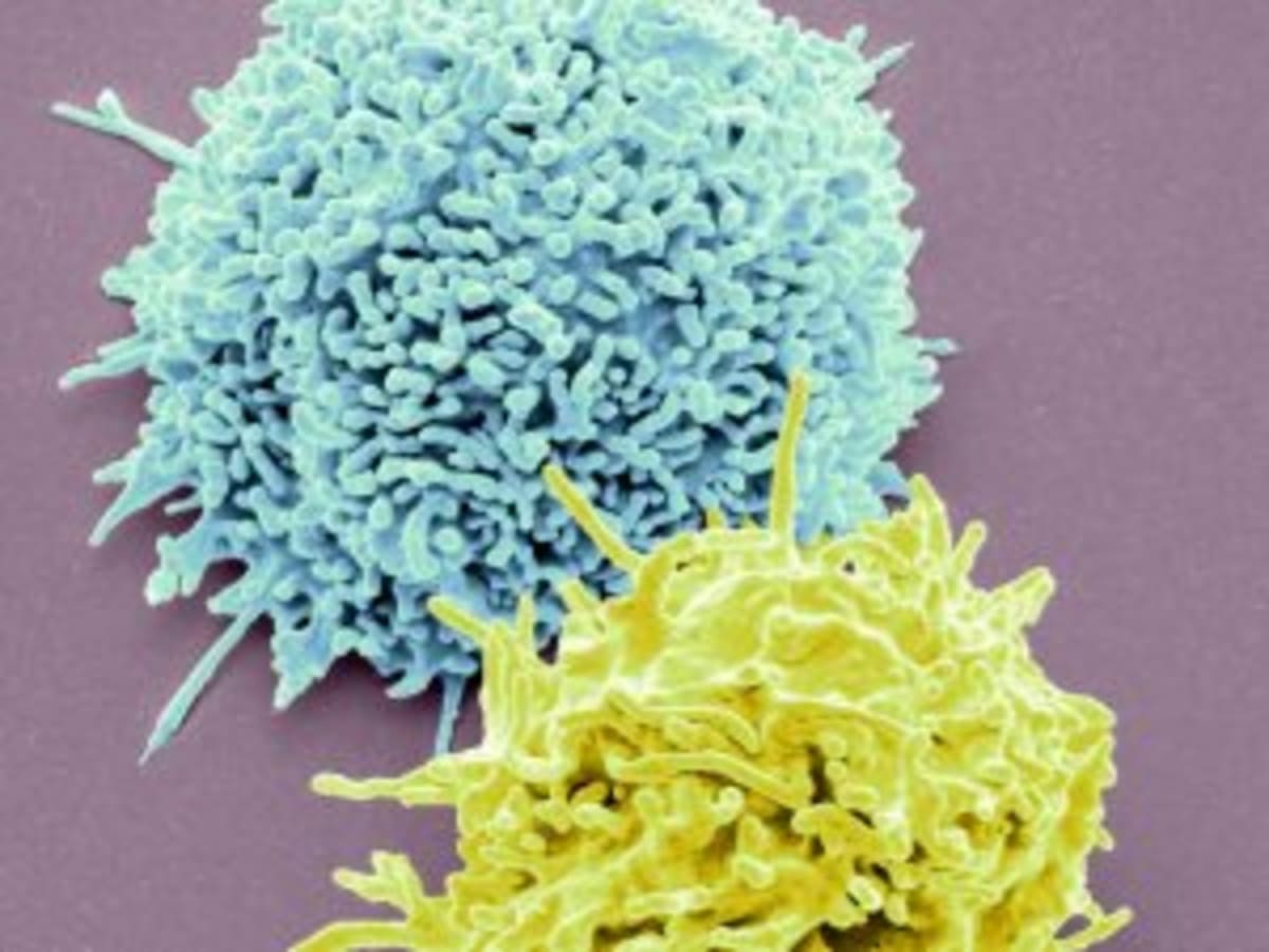 First Drug for Guillain-Barré Shows Success in Trials - Image 4