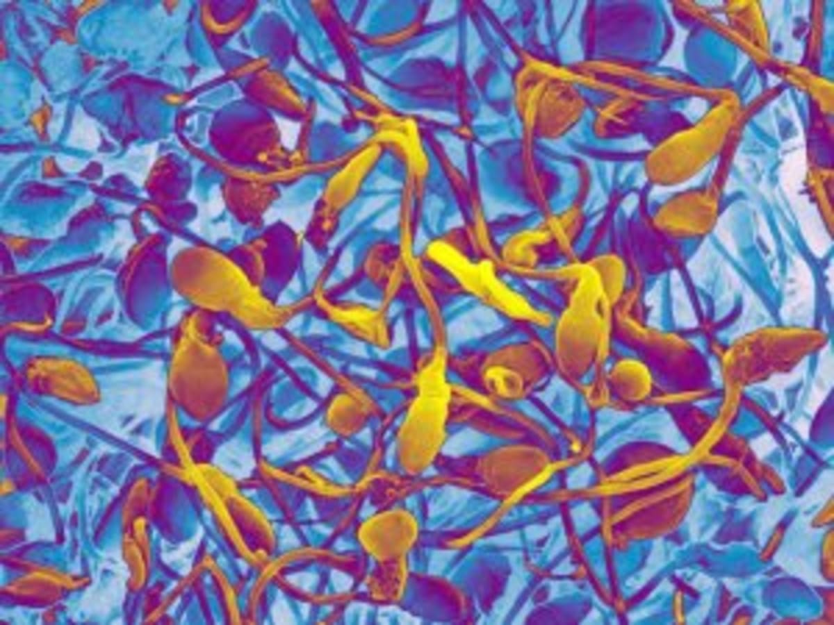 First Protac Drug Approved, Targets Untreatable Diseases - Image 4