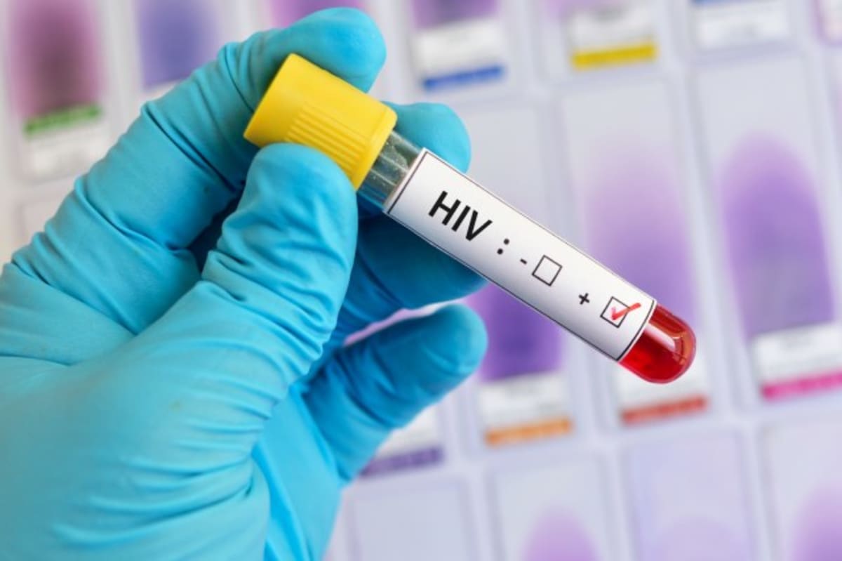 HIV Vaccine Shows Promise in 44% of Primates Tested - Image 2