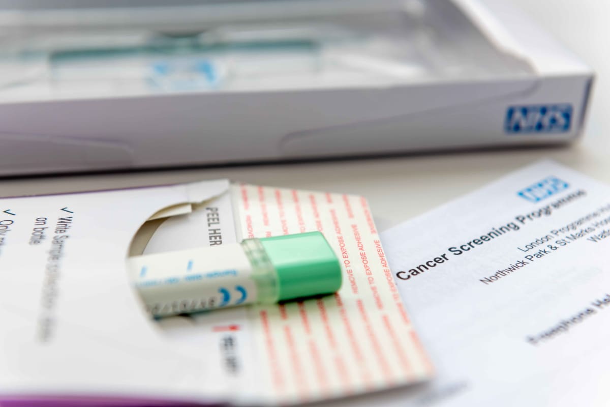 Simple System Change Catches More Colon Cancers Early
