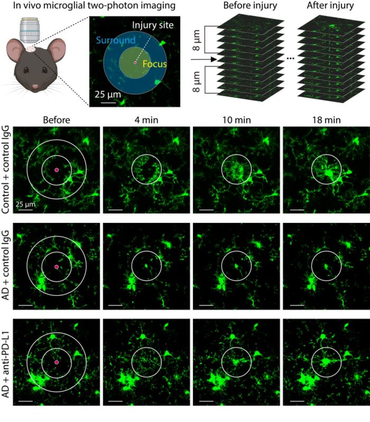 Korean Scientists Restore Brain Function in Alzheimer's Mice