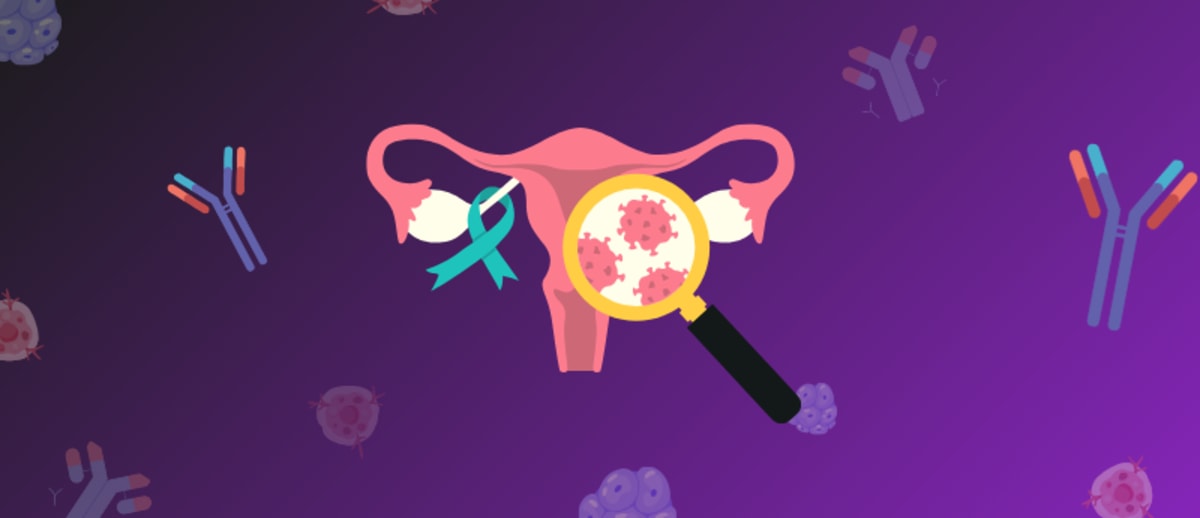 New Drug Shows 50% Response Rate in Ovarian Cancer Trial