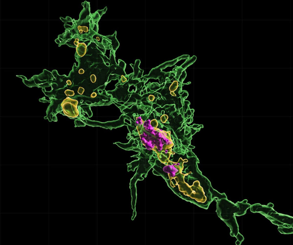 Scientists Discover How to Slow ALS Nerve Cell Death - Image 2