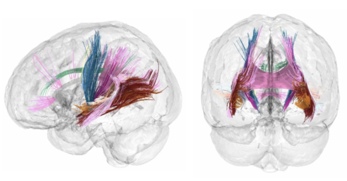 Scientists Map How Pregnancy Transforms the Brain - Image 5