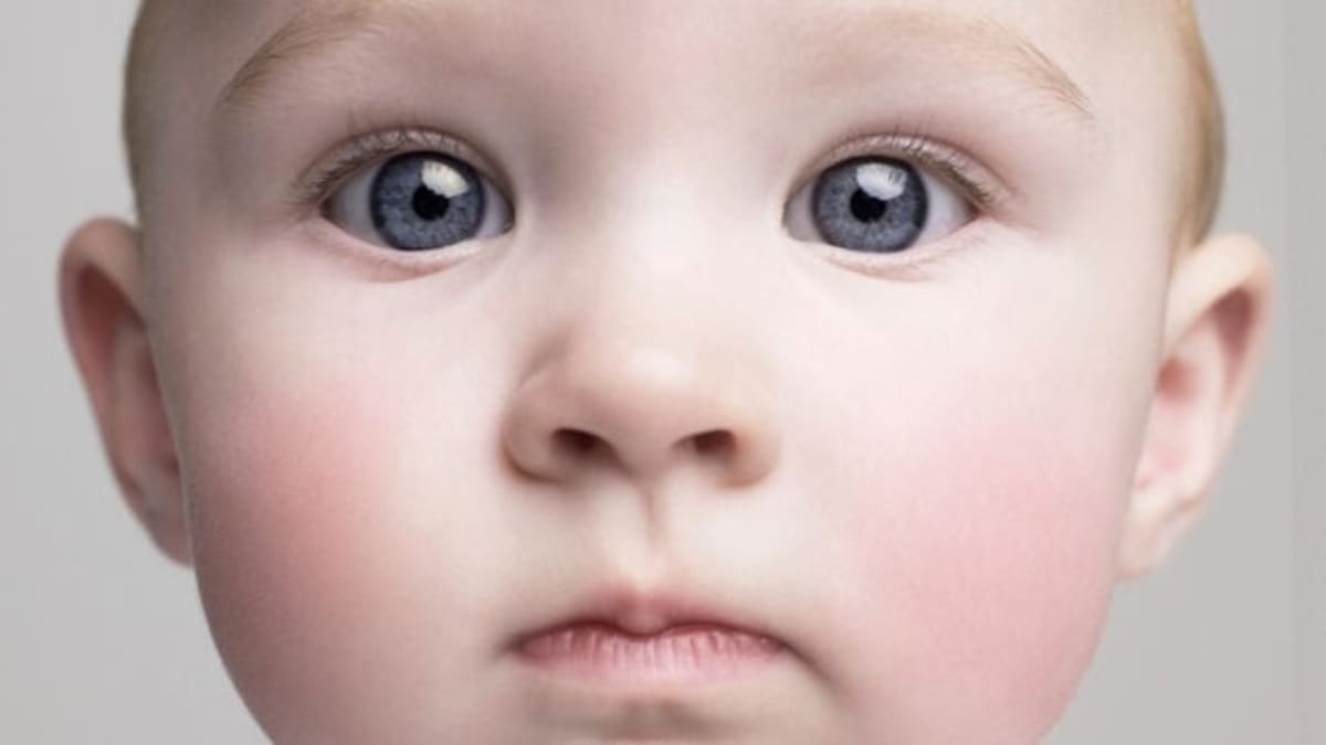 Dementia Prevention May Start in Childhood, Study Finds - Image 2