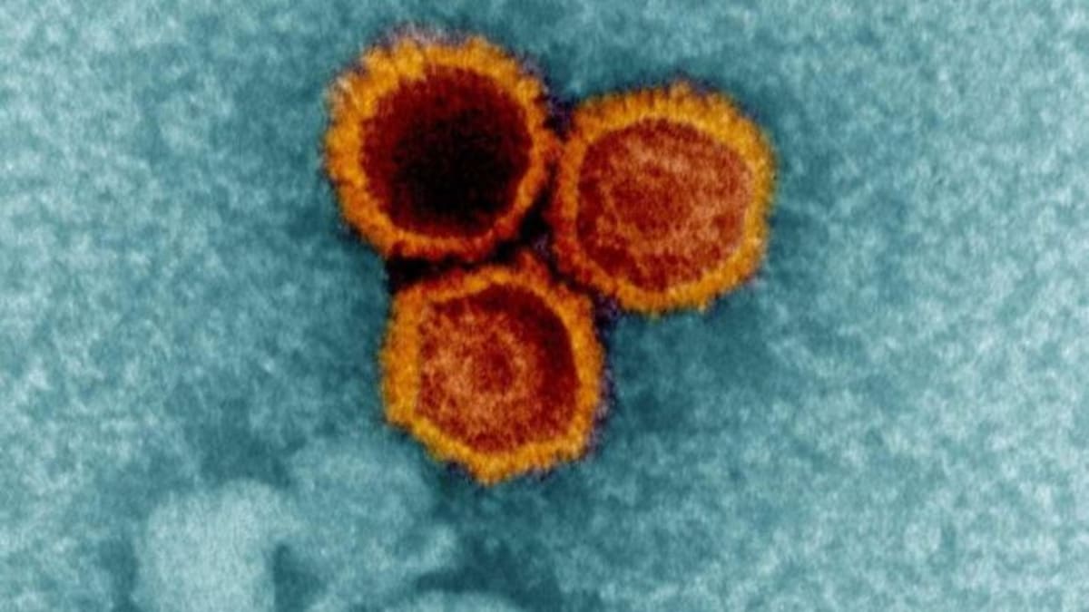 Scientists Find How Common Virus May Trigger MS - Image 2